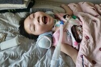 [모금 후기] 분열뇌증을 앓고있는 영진이를 도와주세요!